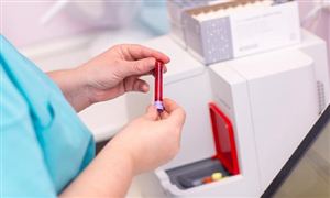 电子化学品行业市场深度调研2024：中国电子化学品需求量及市场规模预测(图2)